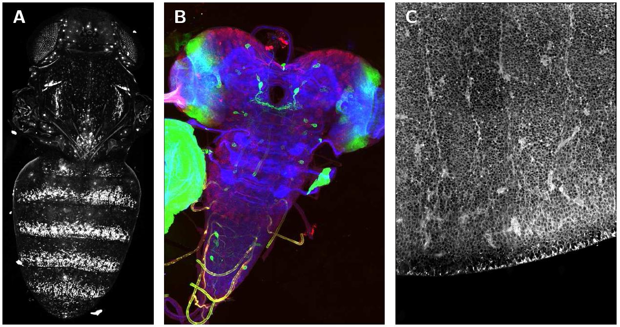 Example of Stitching of 3D confocal stacks.